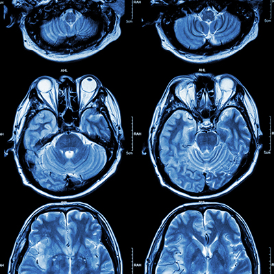 5_7A_FL_StrokeCare_400x400.jpg